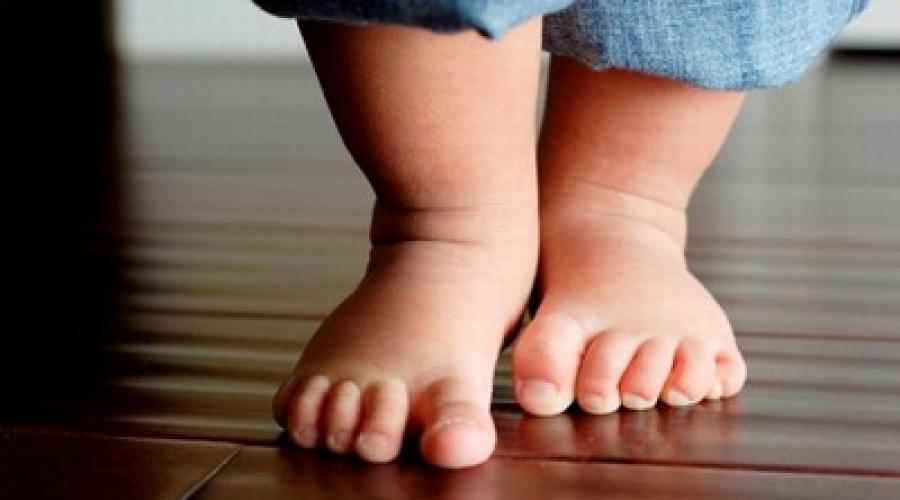 Доктор комаровский о том, как выбрать первую обувь для малыша. Правильная детская обувь: советы ортопеда Нужна ли ортопедическая