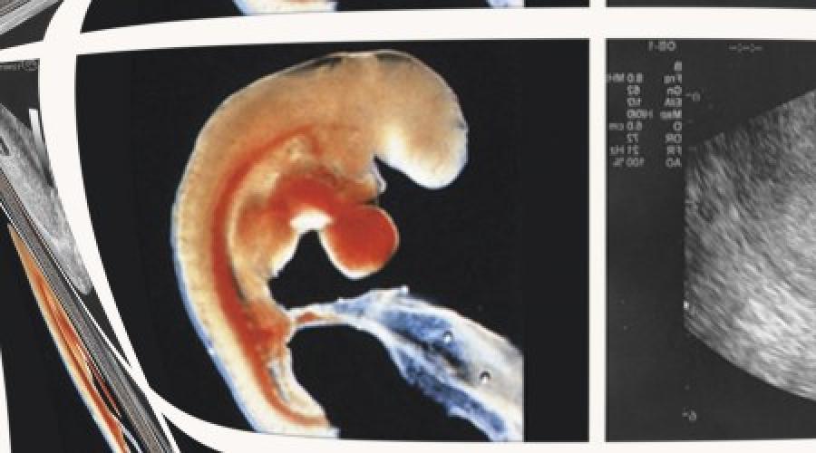 Как выглядит 5 недель беременности фото ребенок